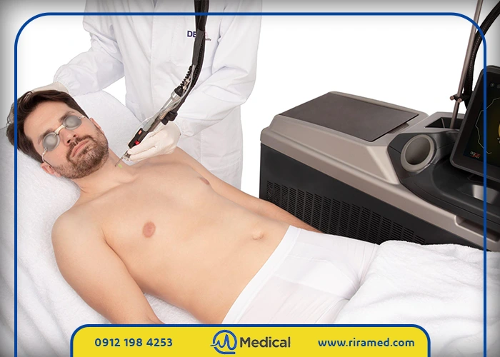 نکات مهم هنگام خرید دستگاه لیزر الکساندرایت دکا