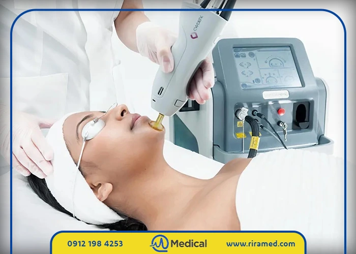 خرید و قیمت دستگاه لیزر الکساندرایت دکا