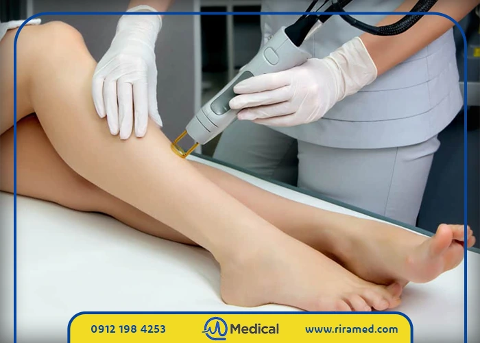 خرید دستگاه لیزر الکساندرایت