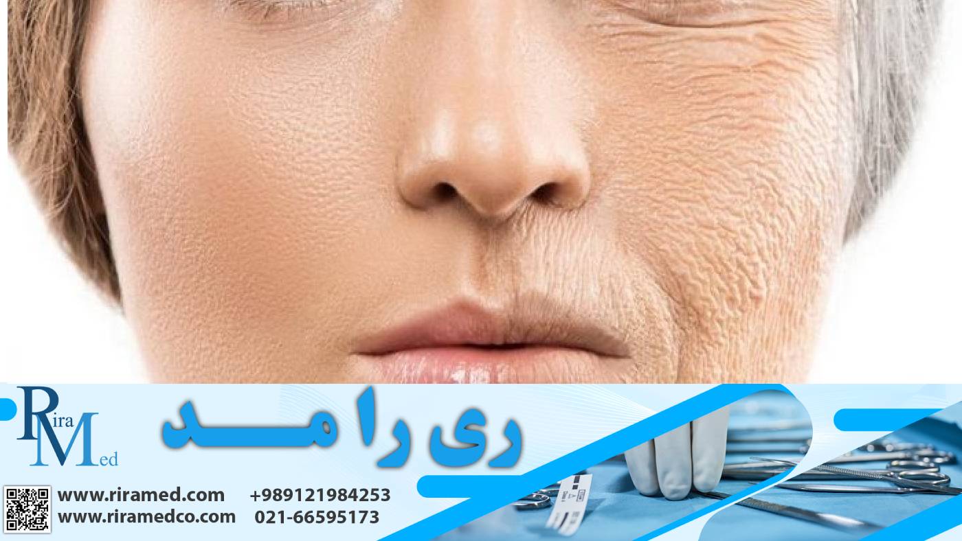 کاربرد دستگاه میکرودرم چیست ؟