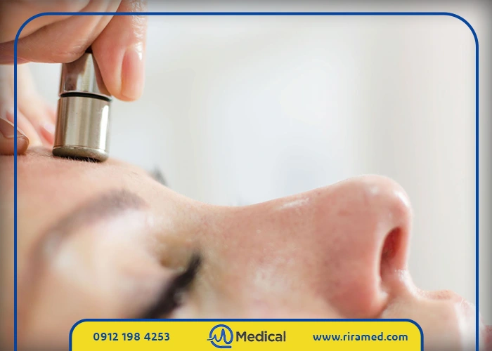 تعداد جلسات مورد نیاز