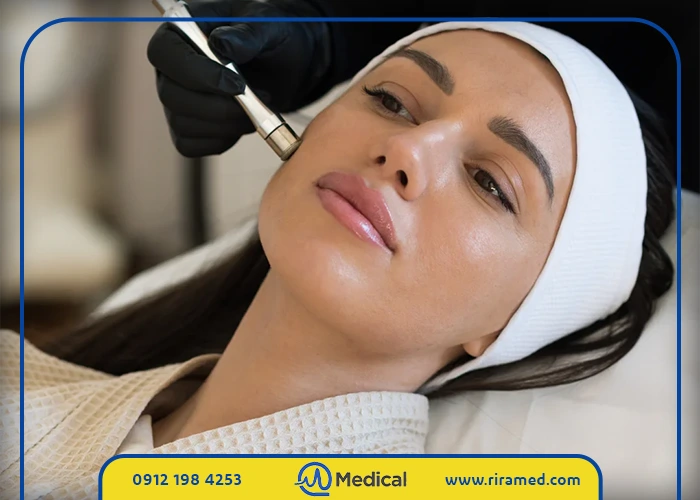 تفاوت میکرودرم با روشهای لایهبرداری شیمیایی