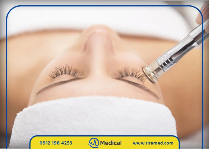 جدول مقایسه فواید میکرودرم با سایر روشهای جوانسازی