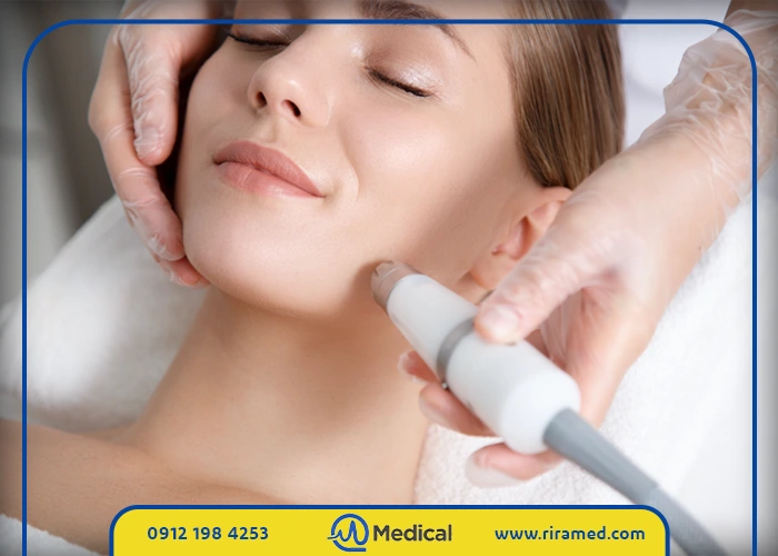 فواید میکرودرم برای پوست