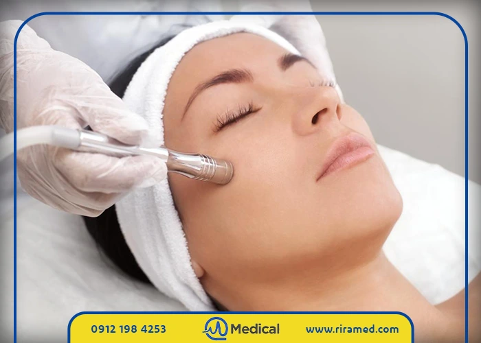 حذف لایه‌های مرده پوست