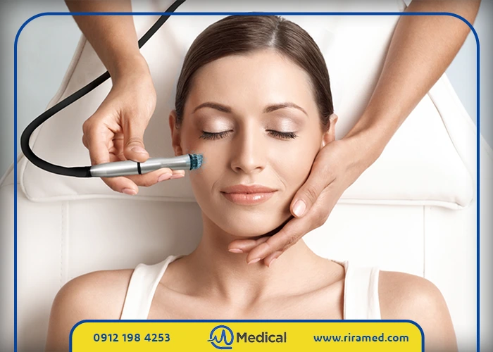 خرید میکرودرم خانگی