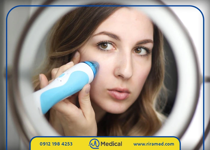 میکرودرم خانگی