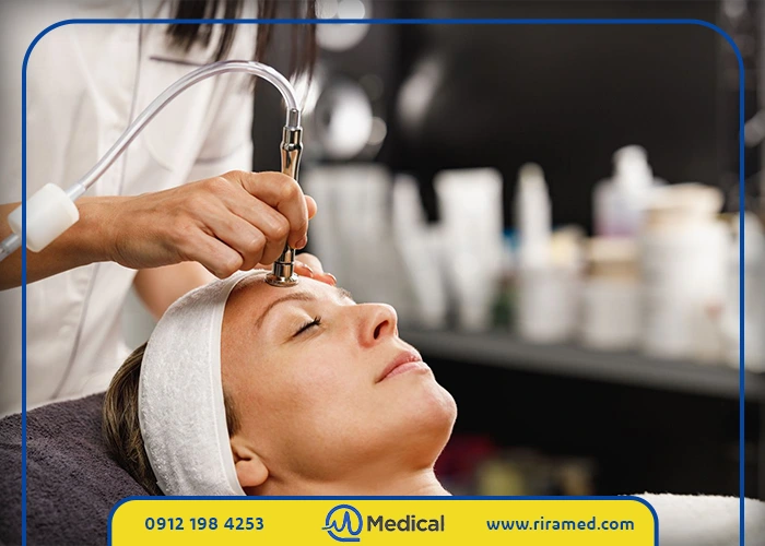 ویژگیهای کلیدی میکرودرم خانگی