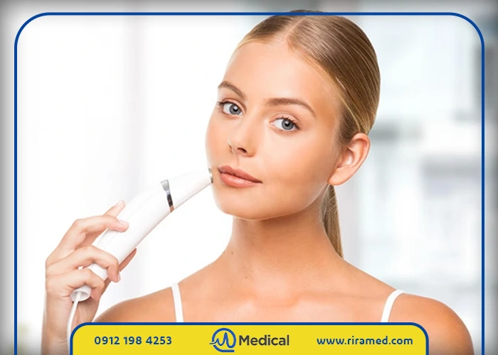 خرید میکرودرم خانگی