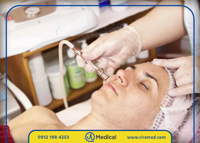 قیمت دستگاه میکرودرم