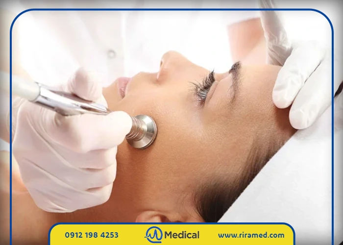 خرید دستگاه میکرودرم