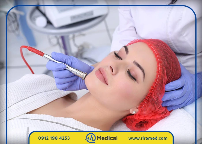 راهکارهای مدیریتی برای بهینهسازی قیمت دستگاه میکرودرم سالنی