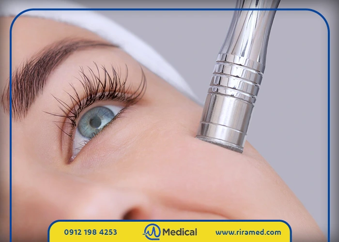 قیمت دستگاه میکرودرم سالنی