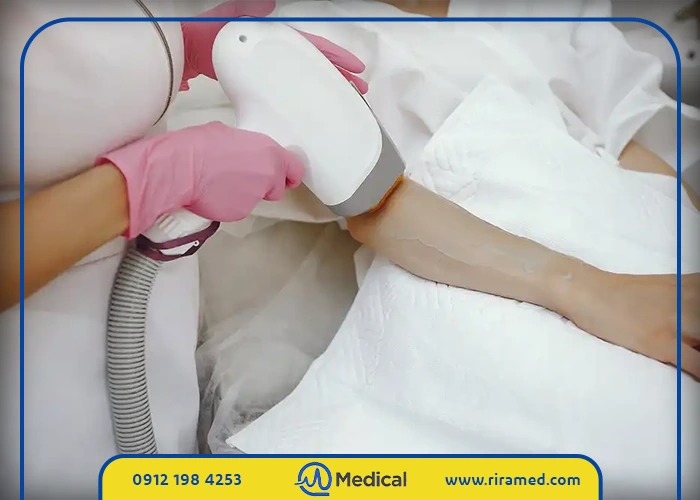 شناخت دقیق نیازهای پوستی: چرا مشاوره با متخصص پوست قبل از لیزر امری ضروری است؟