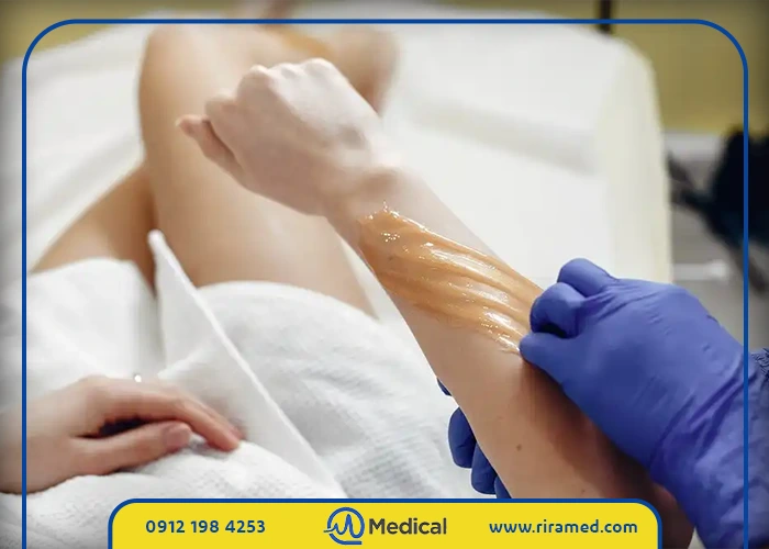 مراقبت از پوست پیش از لیزر: چه اقداماتی باید قبل از جلسه لیزر موهای زائد انجام دهیم تا نتیجه بهتری حاصل شود؟