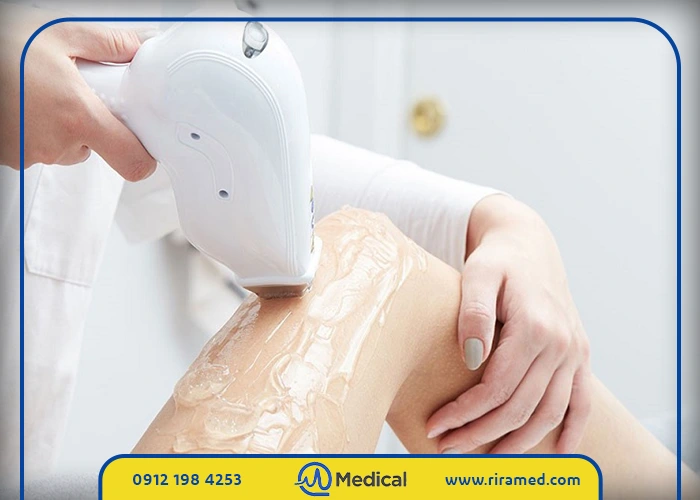 بایدها و نبایدهای روز قبل از لیزر موهای زائد