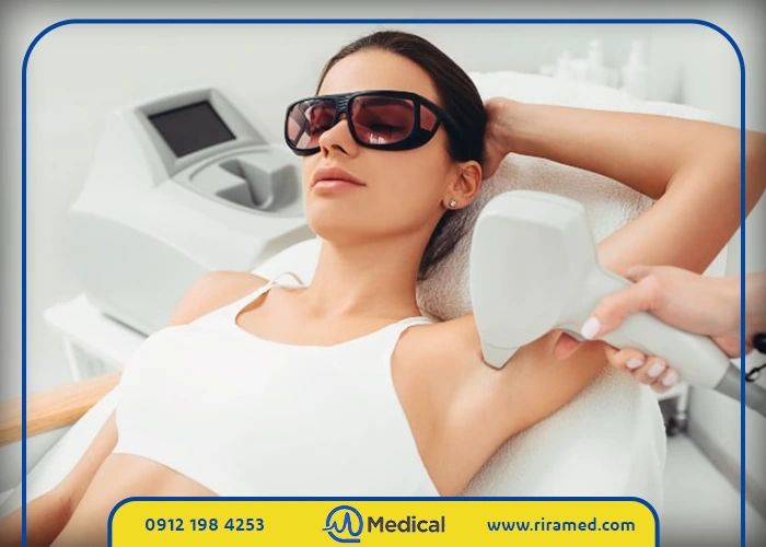 اقدامات لازم برای دستیابی به نتایج دائمی با لیزر موهای زائد